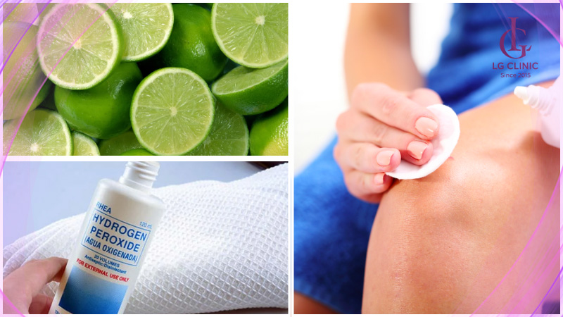 tẩy lông chân bằng oxy già và chanh