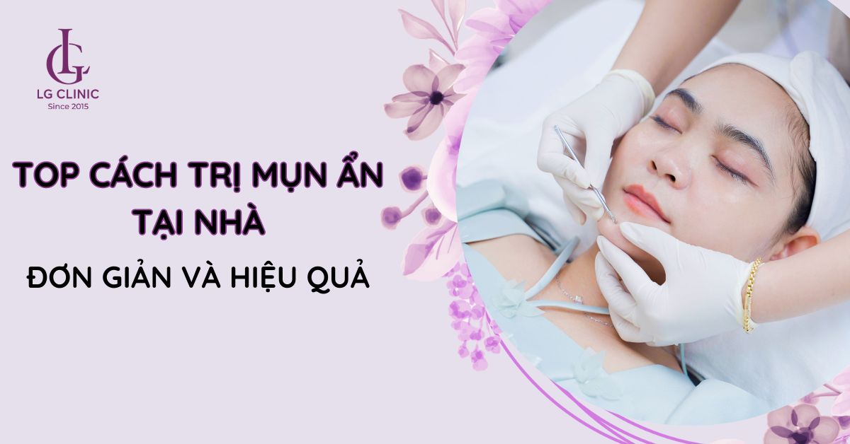 cách trị mụn ẩn tại nhà