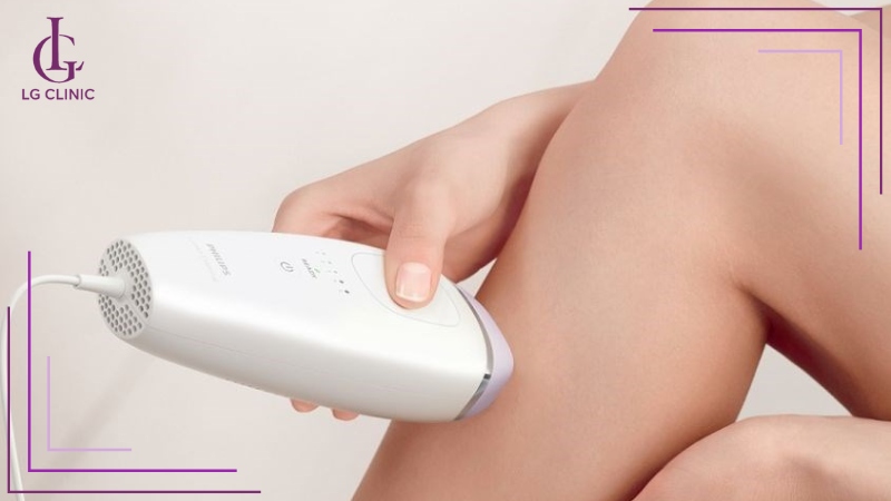 Triệt lông chân bằng máy mini