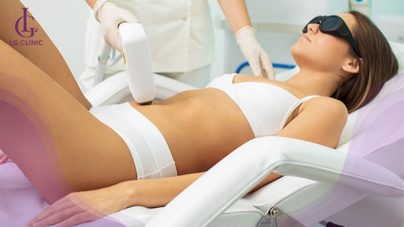 Triệt lông vùng bụng vĩnh viễn