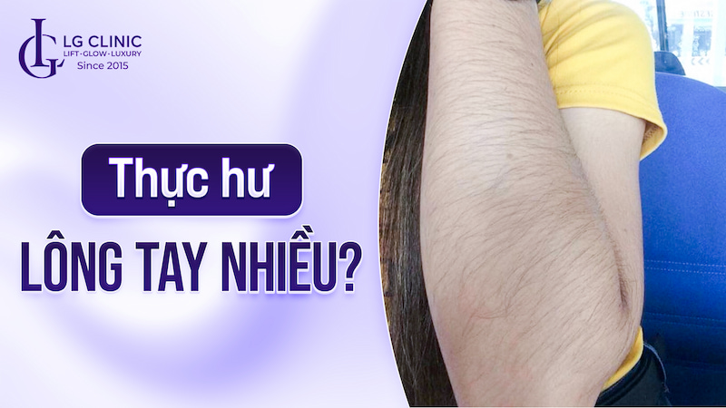 tướng con gái lông tay nhiều