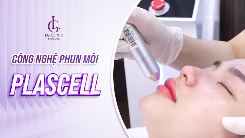 cong-nghe-phun-moi-moi-nhat-2 Công nghệ phun môi Plascell