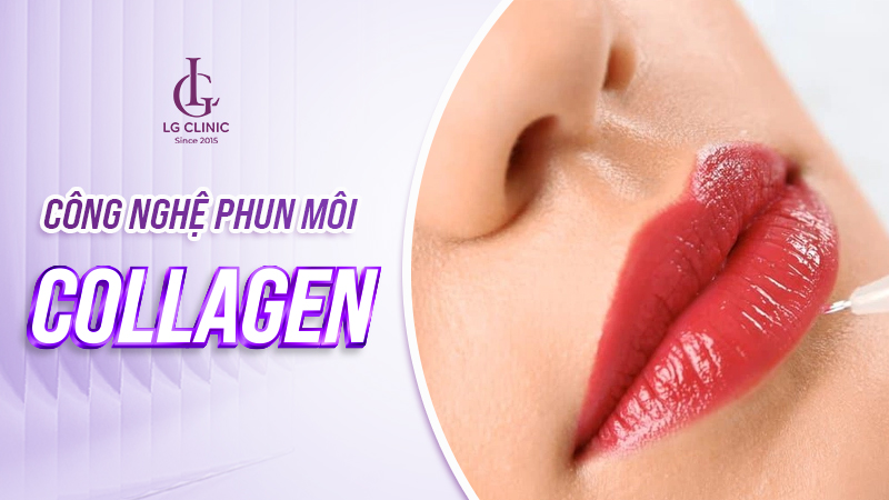cong-nghe-phun-moi-moi-nhat-3 Công nghệ phun môi pha lê