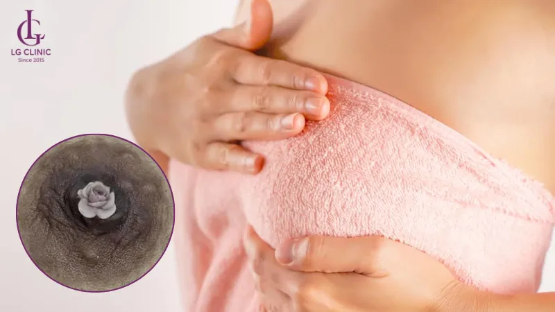 dịch vụ làm hồng nhũ hoa