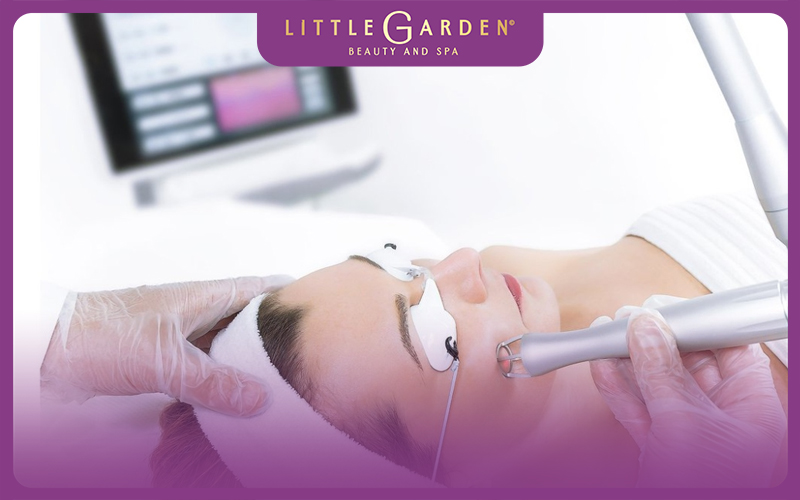 lợi ích khi dùng laser Fractional CO2 trị sẹo rỗ