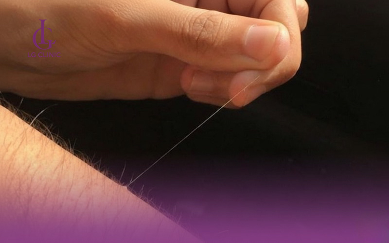 lông tay màu trắng có ý nghĩa gì