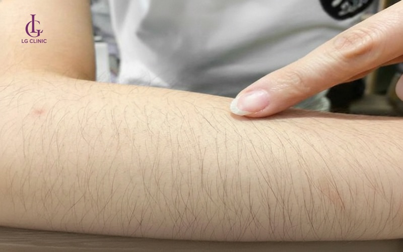 một số câu hỏi liên quan đến lông tay màu trắng