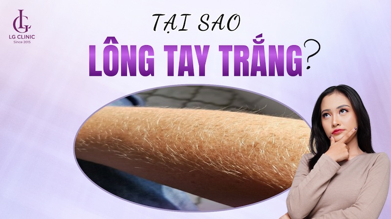lông tay màu trắng