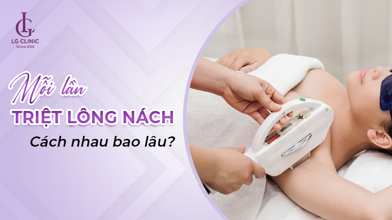 Mỗi lần triệt lông nách cách nhau bao lâu