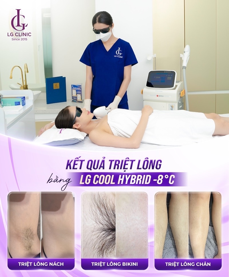 triệt lông lg cool hybrid