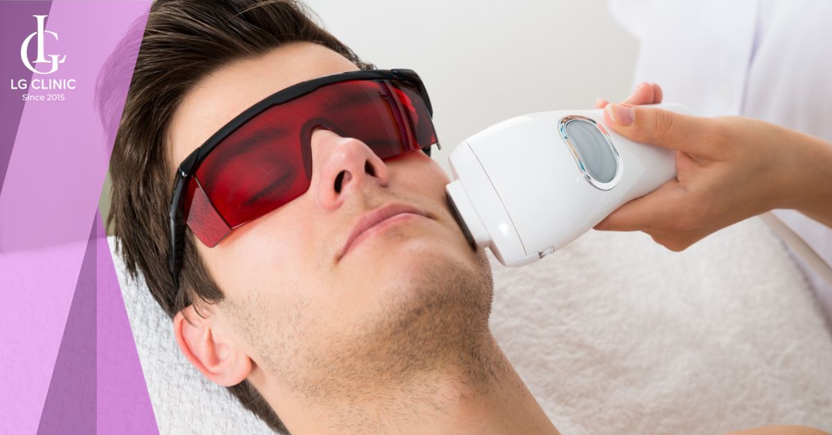 su-dung-laser-de-triet-long-mat-cho-nam Sử dụng laser để triệt lông mặt cho nam