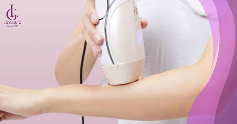 triệt lông tay bằng máy triệt lông