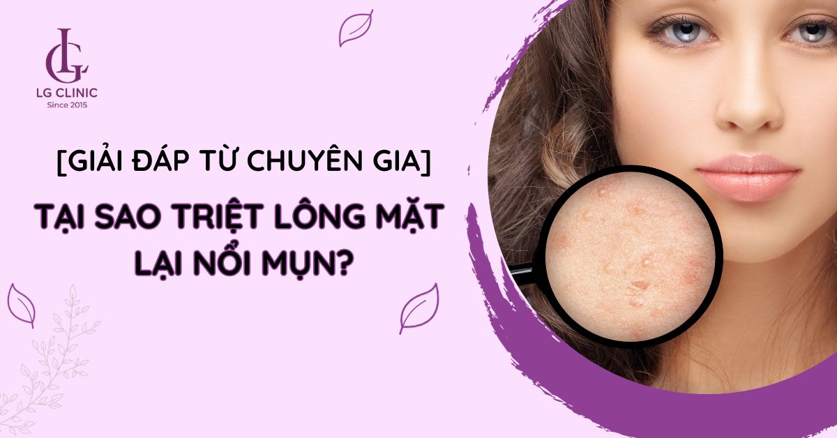 tại sao triệt lông mặt lại nổi mụn