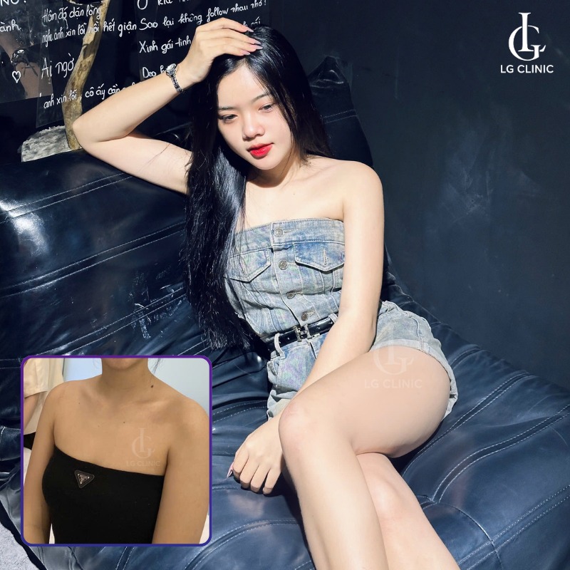 tắm trắng Smartlight 6D