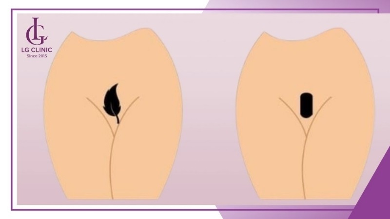 Người mệnh Mộc hợp với dáng bikini hình lá cây, hoa cỏ