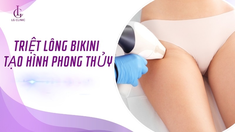 triệt lông tạo hình phong thủy