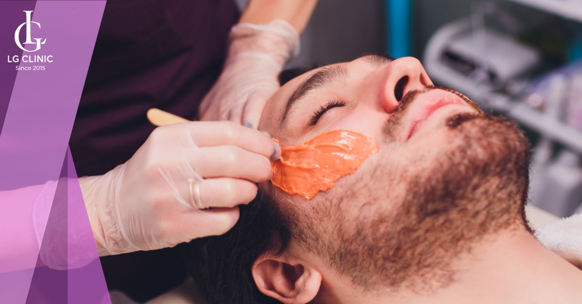 tay-long-mat-nam-gioi-bang-sap-wax-long Tẩy lông mặt nam giới bằng sáp wax lông