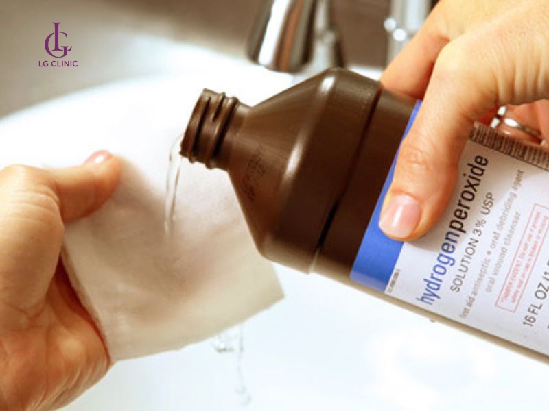 Tẩy ria mép bằng oxy có hiệu quả không?