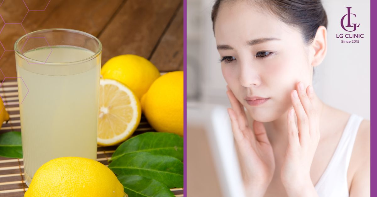 tri-mun-an-tai-nha-hieu-qua-bang-chanh Trị mụn ẩn tại nhà hiệu quả bằng chanh