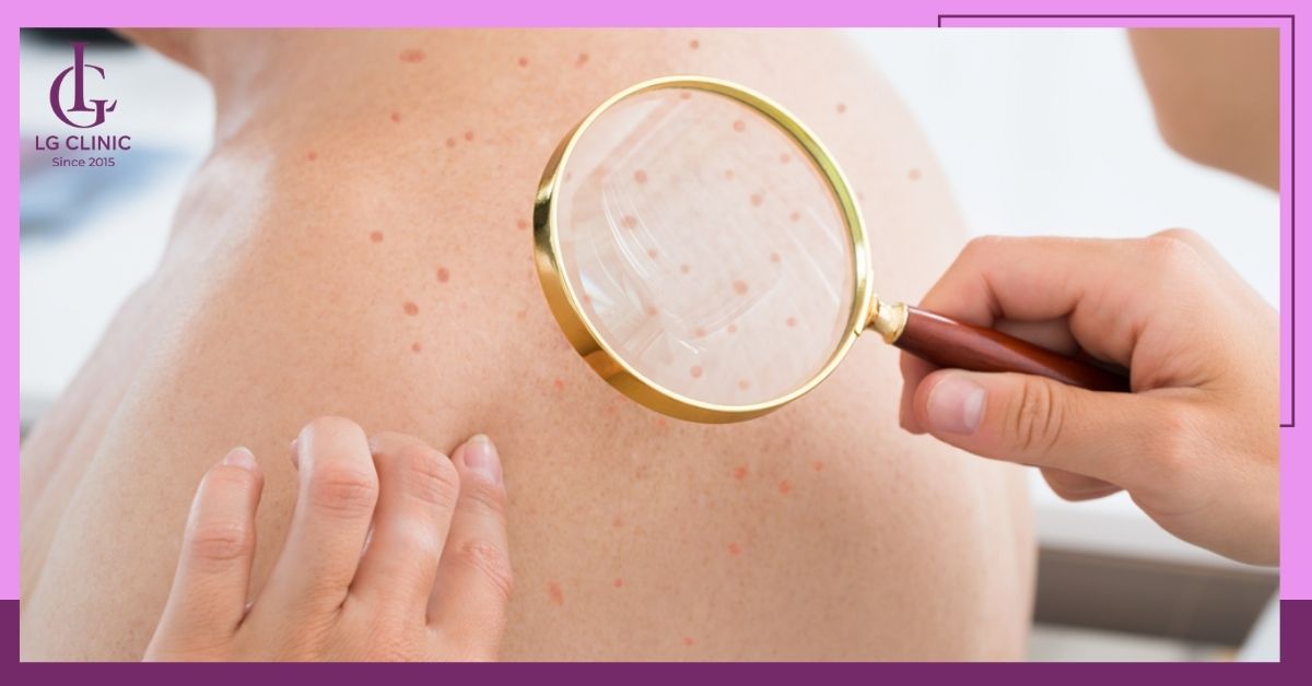 tri-mun-lung-tai-spa-se-duoc-kham-ky-ve-vung-da-bi-mun Trị mụn lưng tại spa sẽ được khám kỹ về vùng da bị mụn