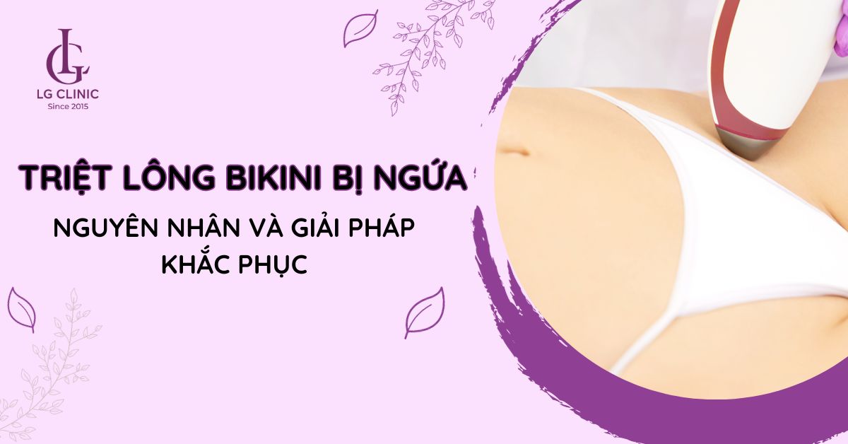 triệt lông bikini bị ngứa
