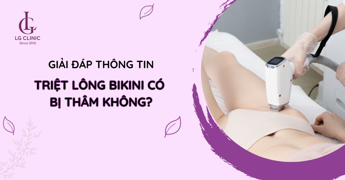 triệt lông bikini có bị thâm không