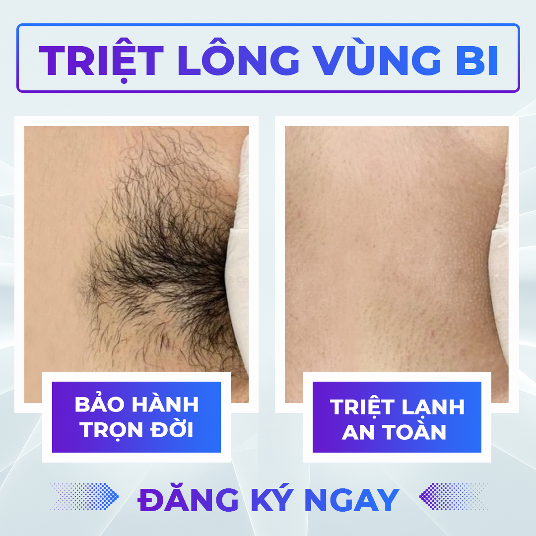 giá triệt lông bikini