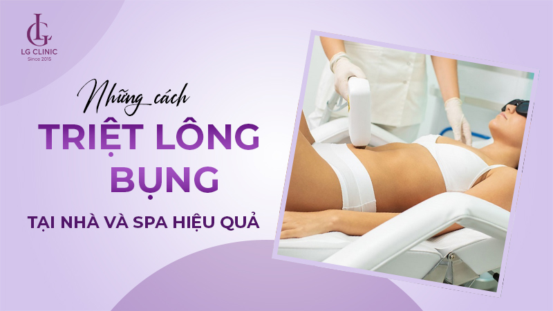 Triệt lông bụng