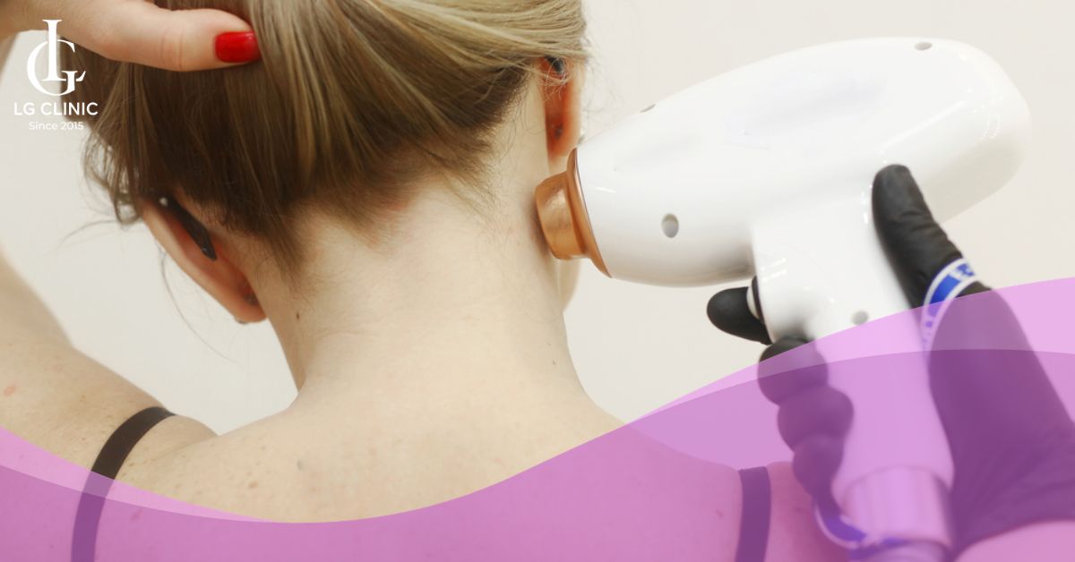 triet-long-gay-hieu-qua-va-an-toan-voi-cong-nghe-diode-laser Triệt lông gáy nữ