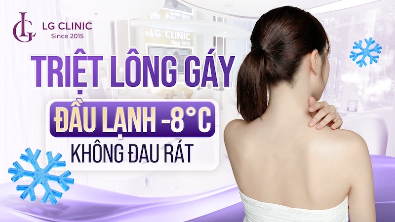triệt lông gáy