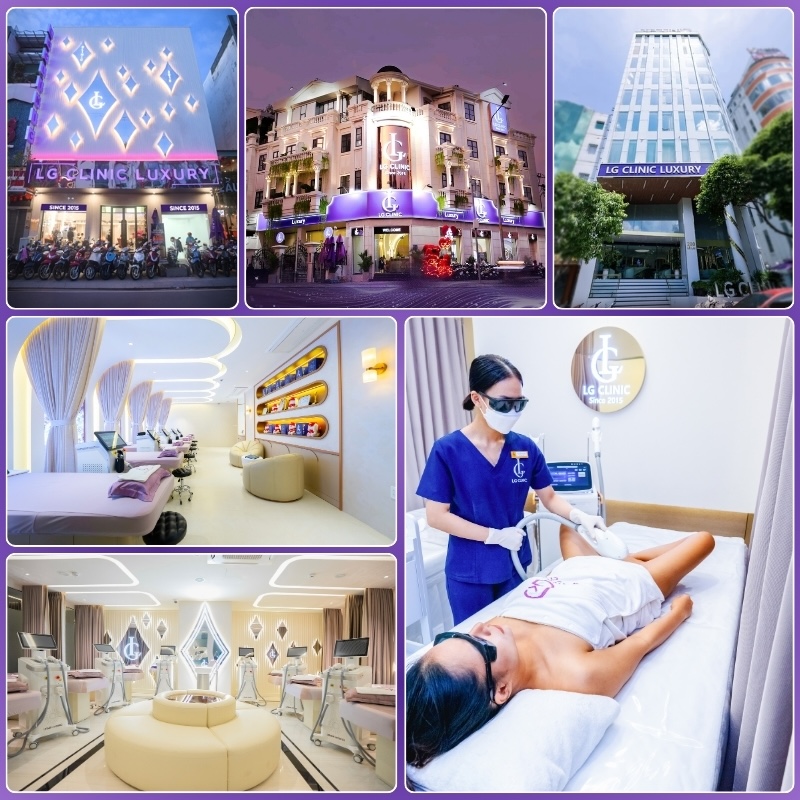 triệt lông tại lg clinic