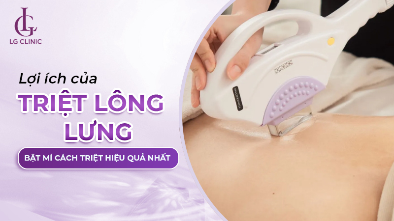Triệt lông lưng