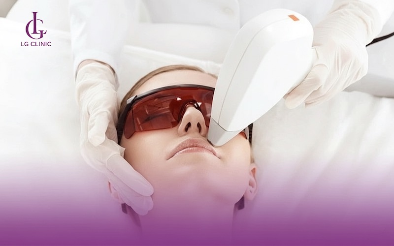 Máy triệt lông Elight tác động nhẹ nhàng, phù hợp triệt ria mép.
