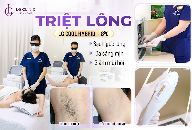 Triệt lông nách có hết hôi nách không