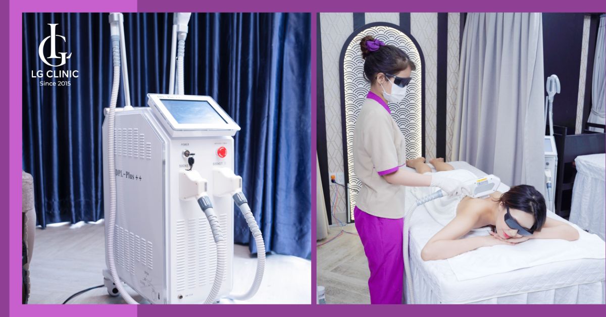 triet-long-voi-cong-nghe-doc-quyen-lg-cool-tai-little-garden-spa Triệt lông với công nghệ độc quyền LG Cool tại Little Garden Spa