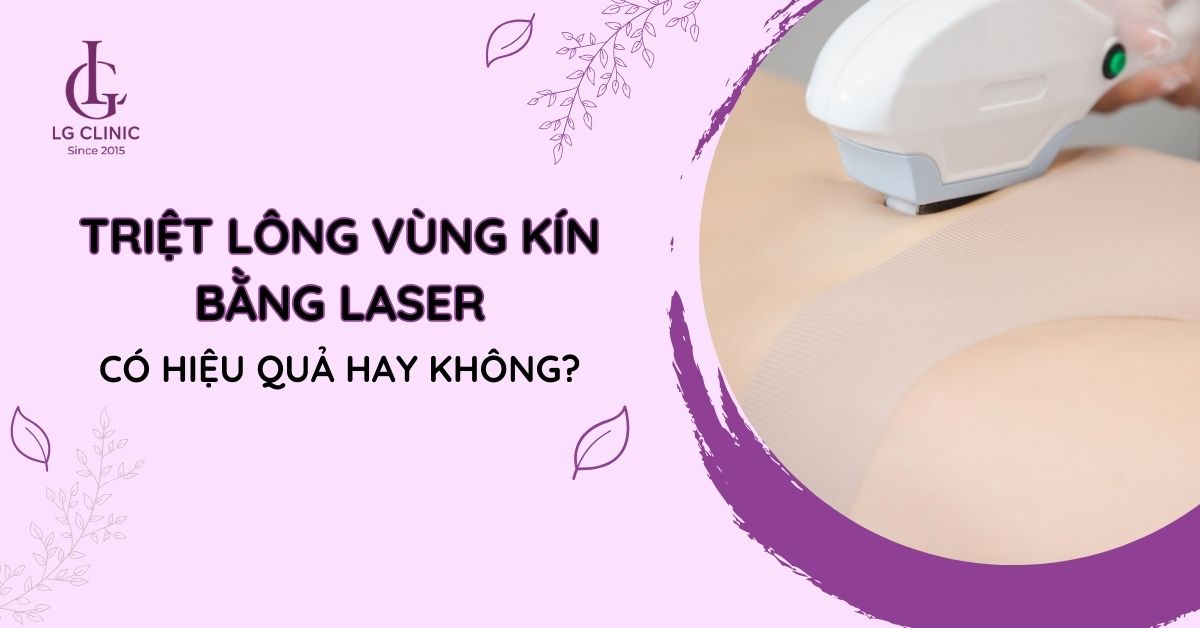 Triệt lông vùng kín bằng laser có thật sự hiệu quả không?