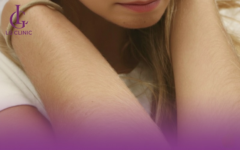 nữ giới sở hữu nhiều lông tay