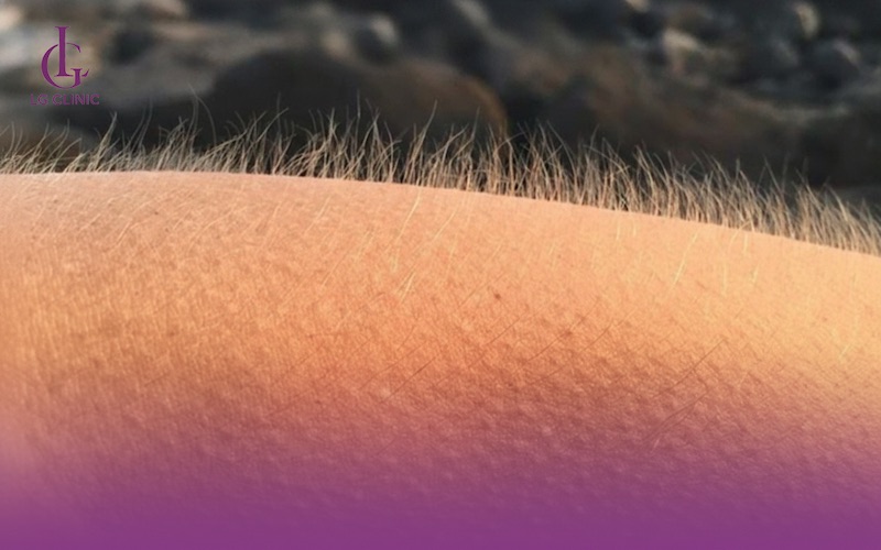 Lông tay dựng đứng