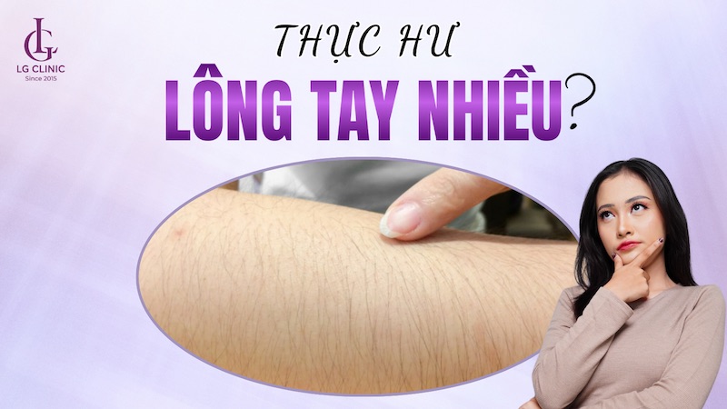 Tướng phụ nữ nhiều lông tay