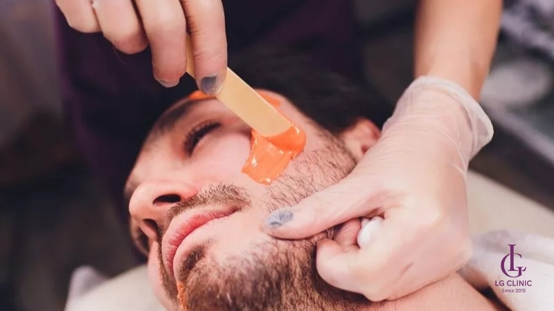 Triệt râu quai nón bằng sáp wax hiệu quả tại nhà