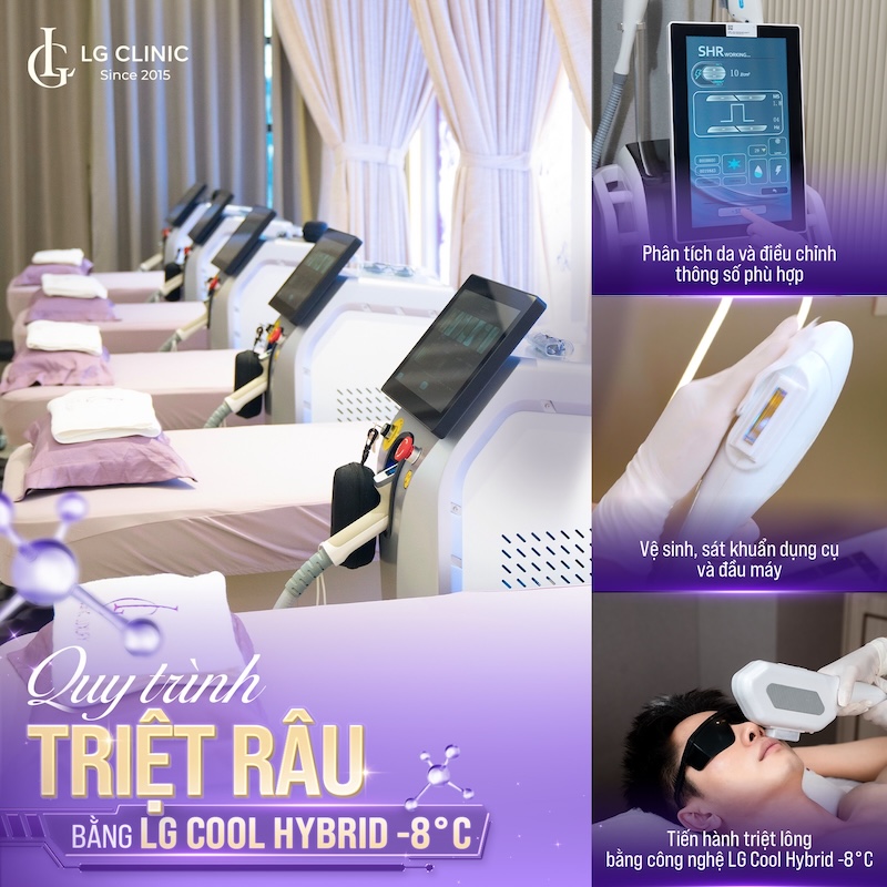 công nghệ triệt râu quai nón vĩnh viễn tại LG Clinic.