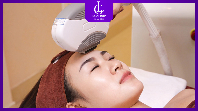 Quy trình triệt tóc trán chuẩn y khoa