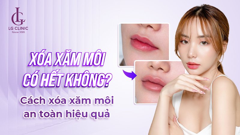 Xóa xăm môi có hết không? Cách xóa xăm môi an toàn hiệu quả