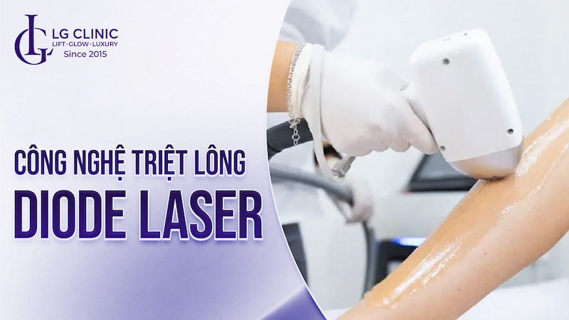 công nghệ triệt lông dpl