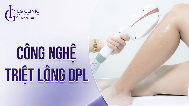 triệt lông dpl là gì