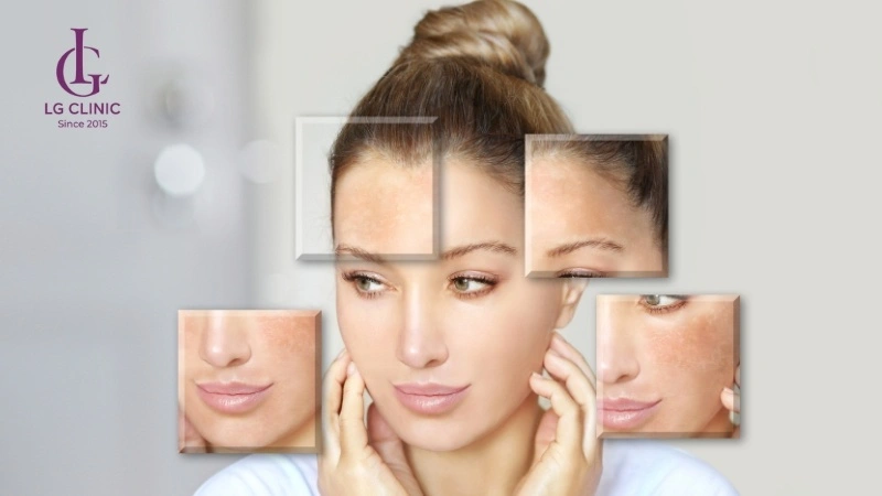 Da đen bẩm sinh có trắng được không