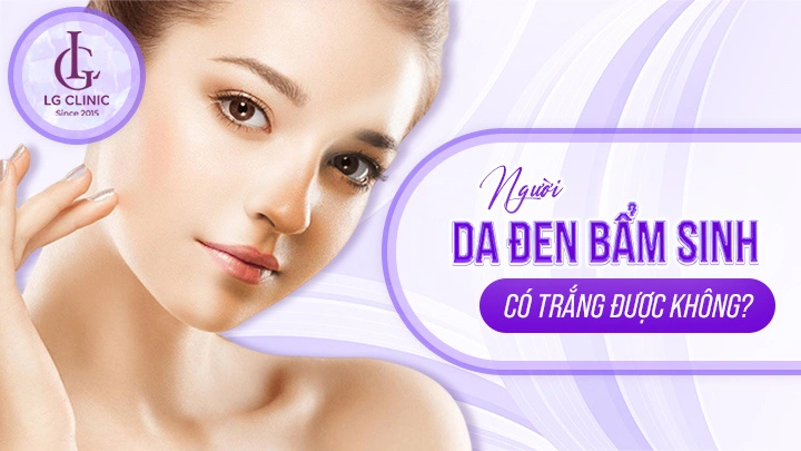 Da đen bẩm sinh có trắng được không