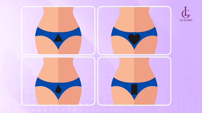 Một số kiểu tạo hình vùng kín gọn gàng, tinh tế được yêu thích nhất