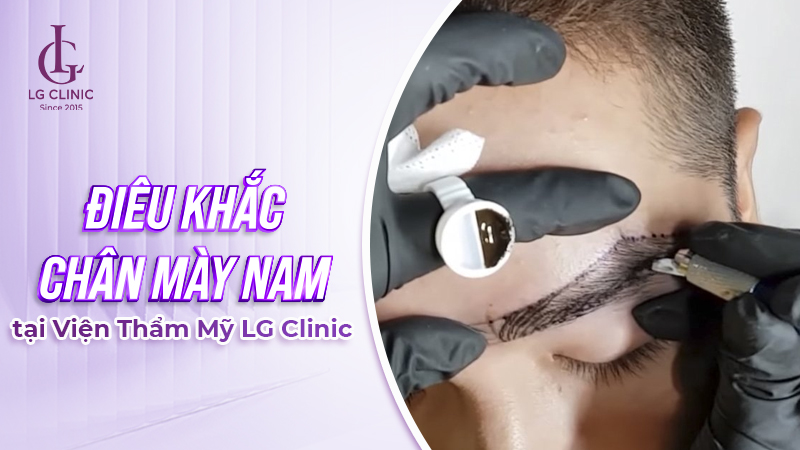 Điêu khắc chân mày phong thủy cho nam tại LG Clinic