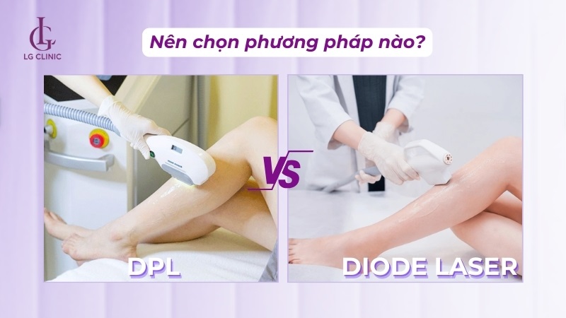 So sánh công nghệ triệt lông Diode Laser và DPL